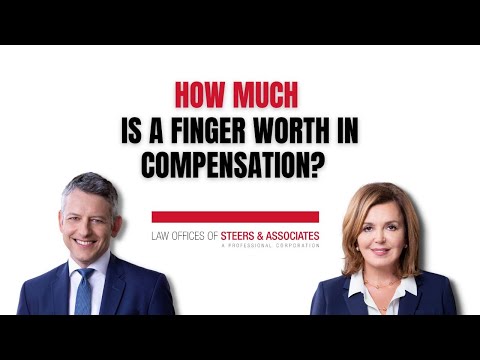 How Much is a Finger Worth in Compensation?