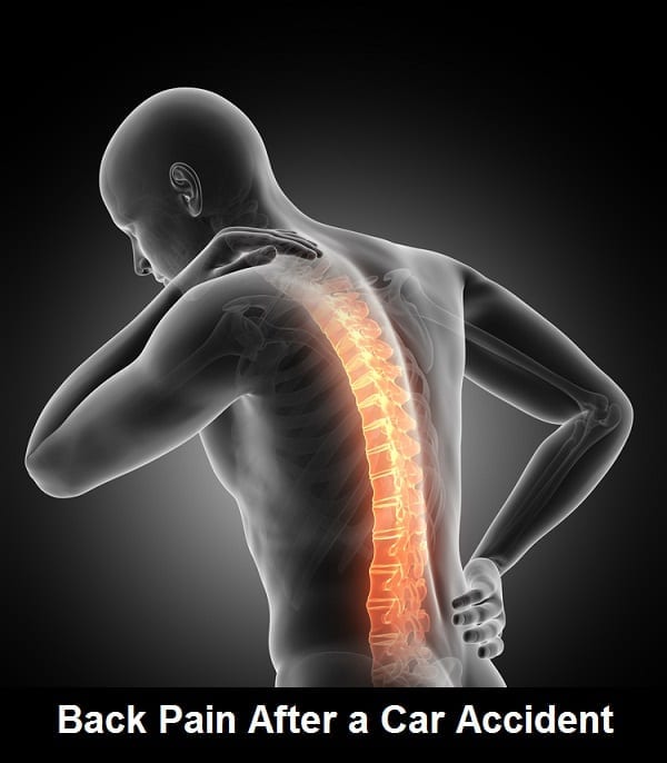 Back Pain After A Vehicle Accident in Los Angeles