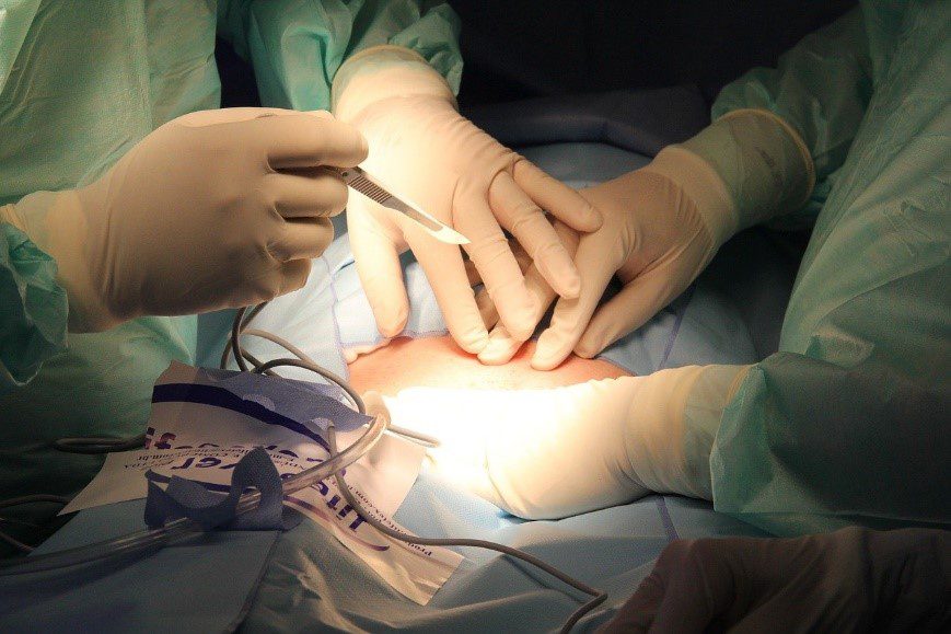 Doctors performing a spinal fusion surgery