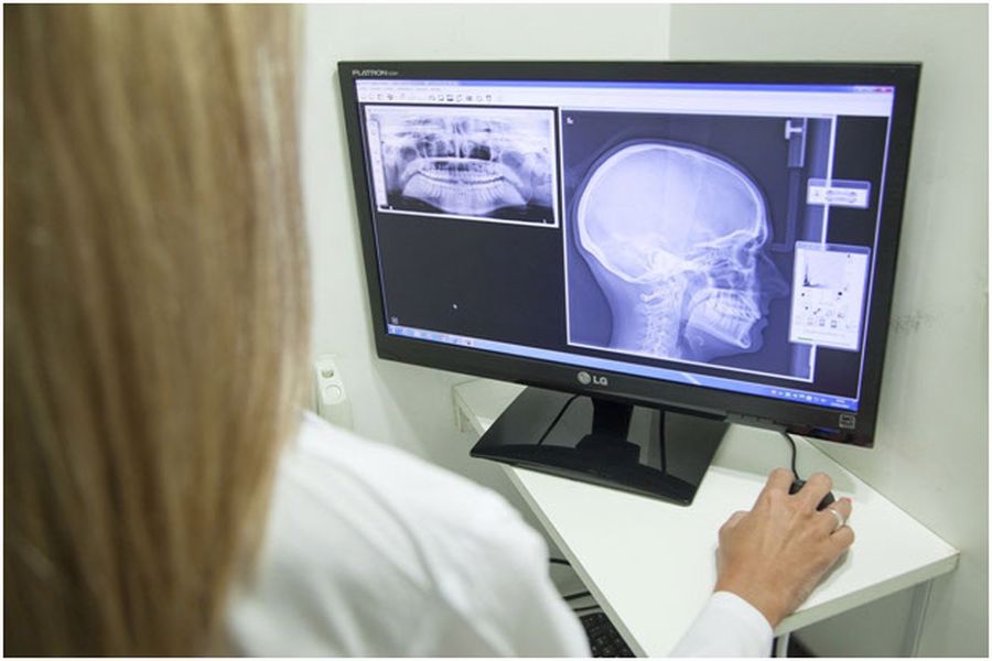 Doctor looking at X Ray of Skull