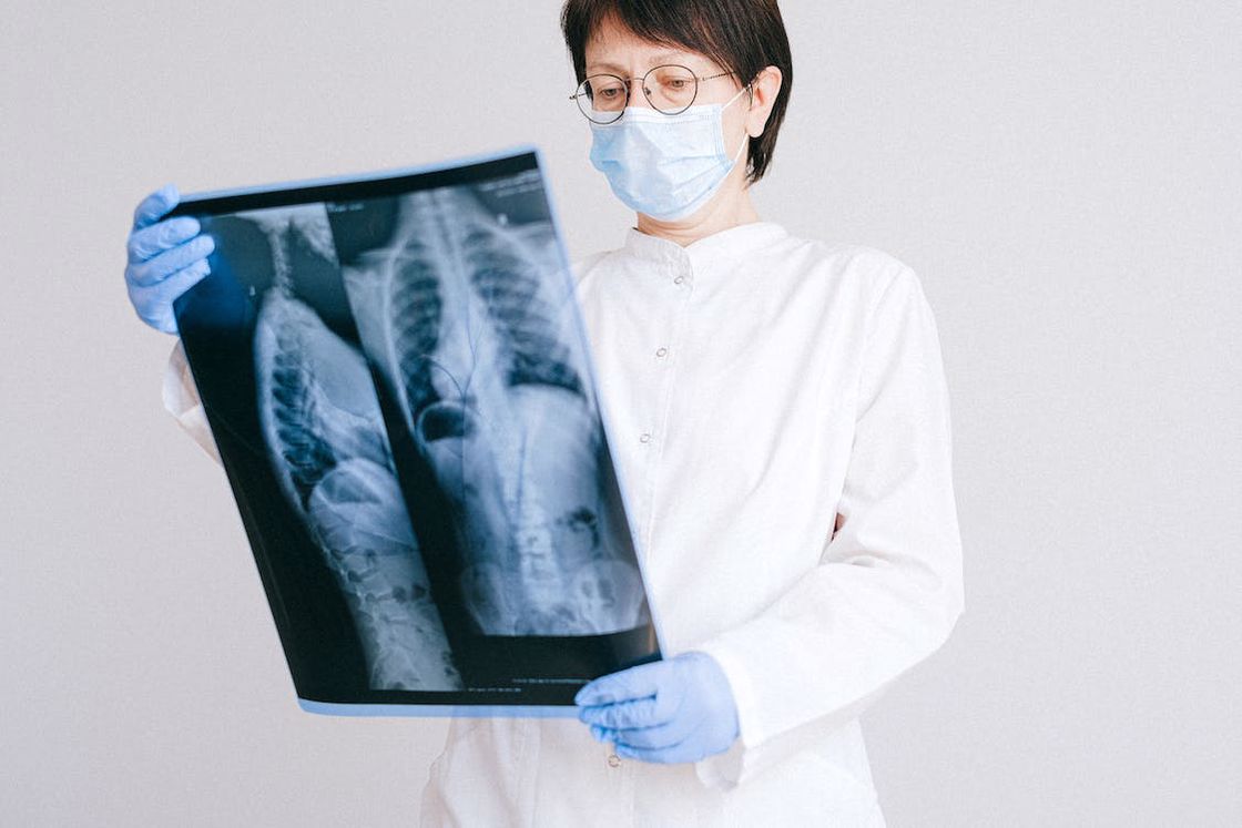 Doctor looking at a chest X-ray result