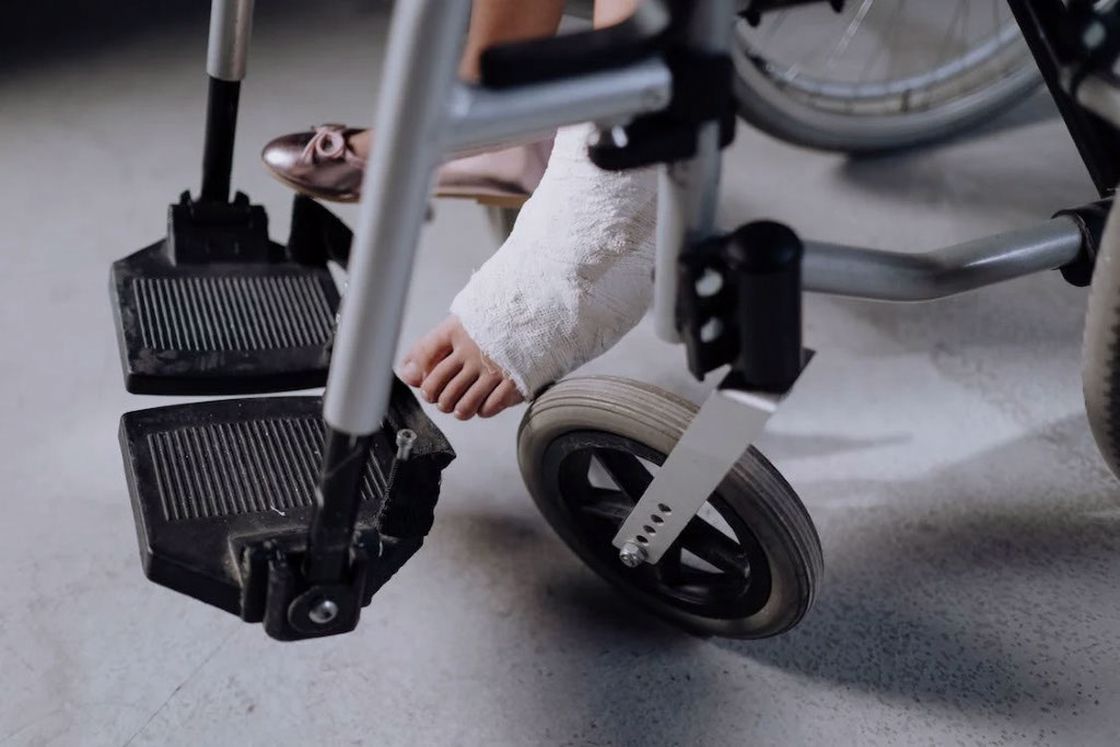 Girl sitting in a wheelchair with a foot cast