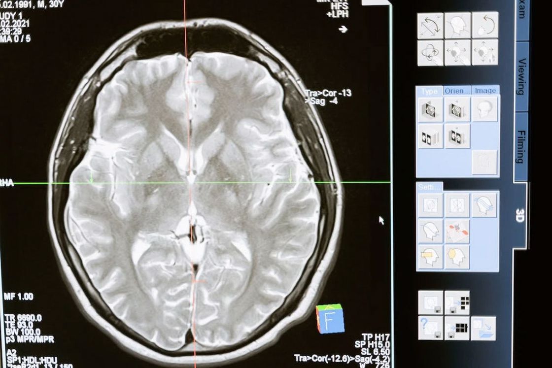 X ray imaging of a human brain